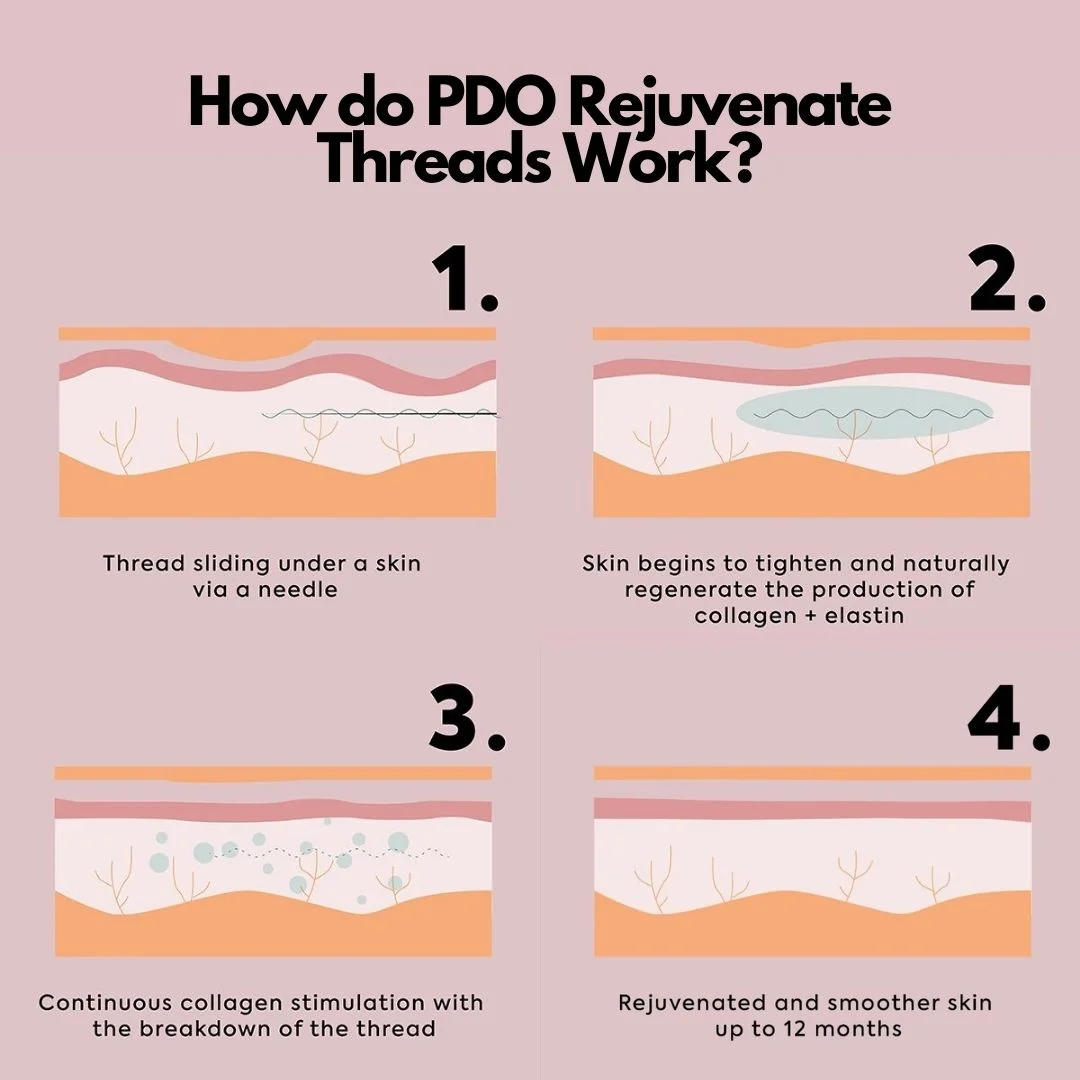 What are PDO Rejuvenate Threads?