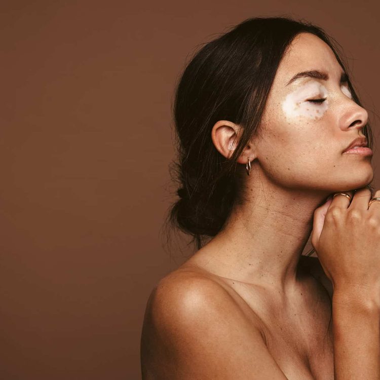 Skin Tightening Treatment in Melbourne